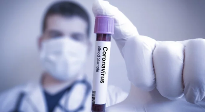 Ölü sayısı 77! Günlük koronavirüs verileri açıklandı