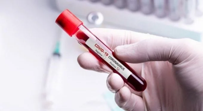 Kan grubu A olanların virüse yakalanma riski daha yüksek olabilir!