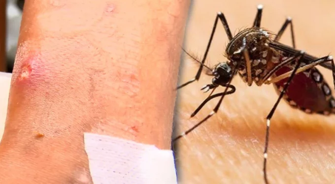 Asya Kaplan Sivrisineği alarmı! Bursa dahil 13 ilde görülüyor