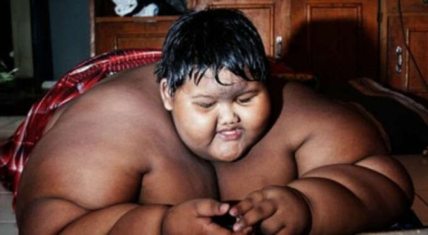 Dünyanın en şişman çocuğuydu... 110 kilo verdi!