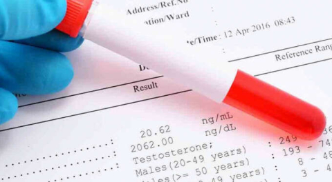 D vitamini testi aç karnına mı yapılır?