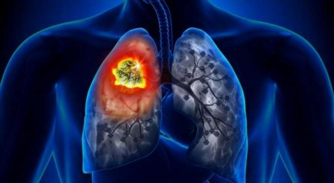 Bursa'dan hayati uyarı: Kanser riskini artırıyor!