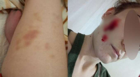 Arkadaşının kocası dehşeti yaşattı! 'Alevlerin arasında kaldık...'