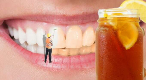 Dişlerinizin rengini değiştiren 7 ilginç alışkanlık!