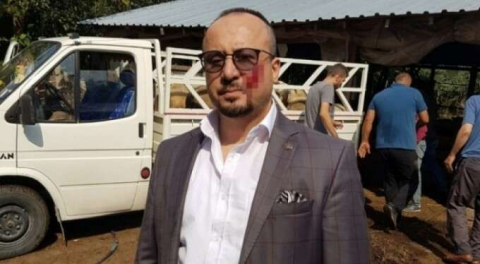 Cezası belli oldu! Bursa'da haciz sırasında avukatın yanağını ısırmıştı!