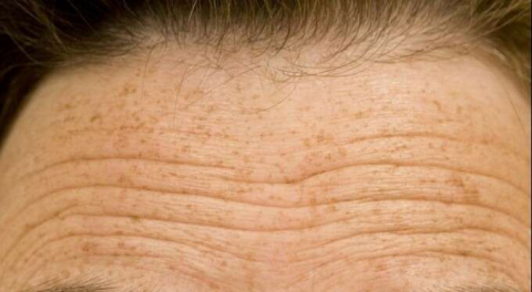 Kırışıklıklara karşı savaşan 6 doğal yağ!