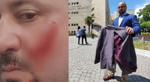 Bursa'da yanağını koparmıştı... Avukat cezaya isyan etti!