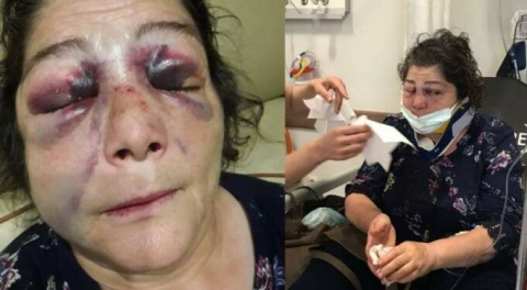 Kadını döverek bu hale getirdiler!