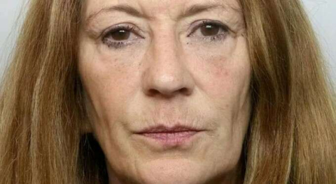 Uykusunda yakaladı! Şekerli kaynar su ile kocasını yaktı