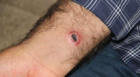 ORF hastalığına dikkat!