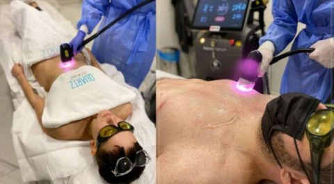 İstenmeyen tüylerden kurtulmada  'Buz Lazer Epilasyon'  farkını biliyor musunuz?