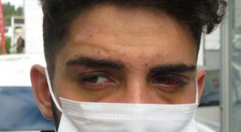 Korna çaldı diye bayıltana kadar dövdüler