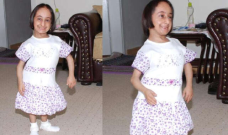 Türkiye'nin en kısa boylu kadını Elif Kocaman'dan acı haber!
