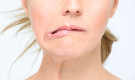 Dikkat! Soğuk hava yüz felcini arttırıyor