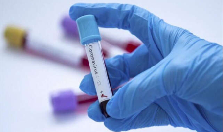 13 Şubat koronavirüs tablosu açıklandı