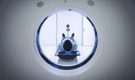 Kovid-19 geçirenlerin beyin boyutunda küçülme gözlemlendi 