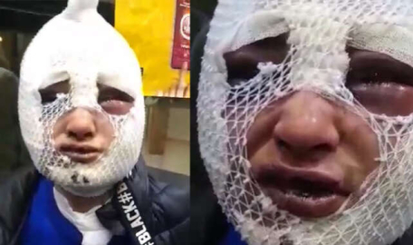 Eski sözlüsünü dövdü, kızgın yağla yaktı! Şok karar