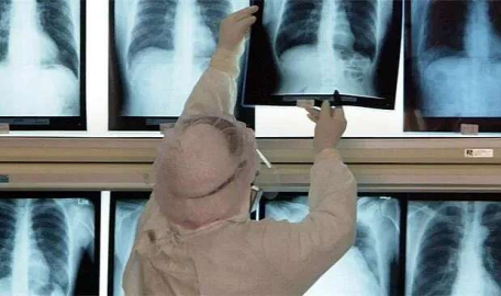 Yapay zekalar röntgenden ırk tahmini yapabiliyor