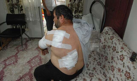 Dehşet dolu anlar... Ayı saldırısından nasıl kurtulduğunu anlattı