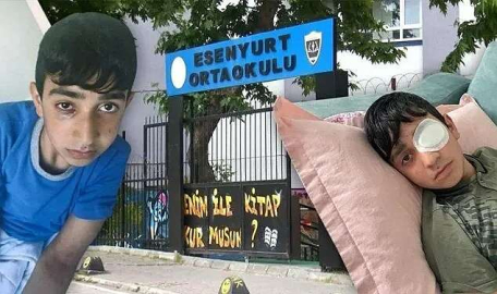 Okulda 'kız' kavgası! Görme kaybı yaşadı