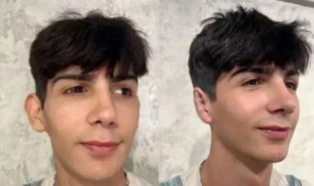 Taha Duymaz bu kez de kulaklarını yaptırdı