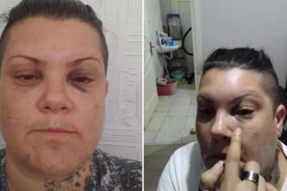 Popstar Evren saldırıya uğradı