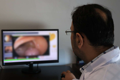 Bağırsaktaki tümör kansere dönüşmeden çıkarıldı