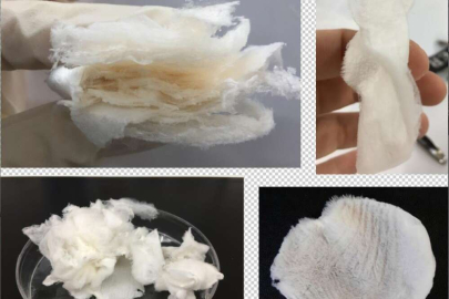 BTÜ'lü araştırmacılar o hastalığa çare oluyor