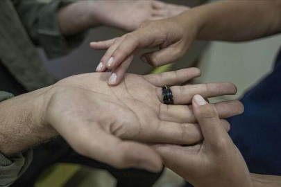 El terlemesine 50 dakikada kalıcı çözüm