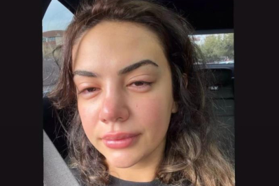 Ece Ronay'a eski eşinden şiddet