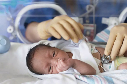 Bebekler ne kadar erken doğarsa sorunlar o kadar artıyor