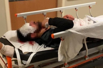 Bursa'da kaza yaptı, olay yerinden 1 buçuk kilometre ileride bulundu