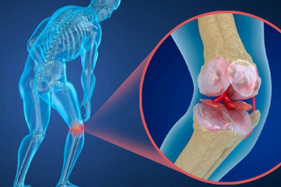 Hangi besinler kemiklere iyi gelir?