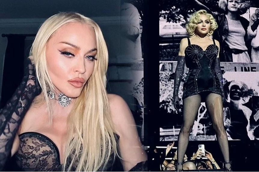 4 gün komada kalan Madonna: Hiçbir şey beni durduramaz