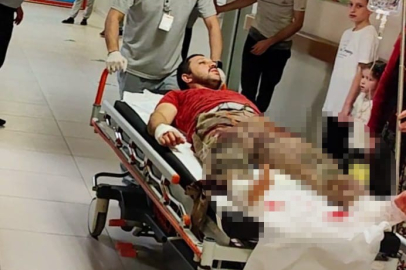 Bursa'da odun keserken az daha canından oluyordu