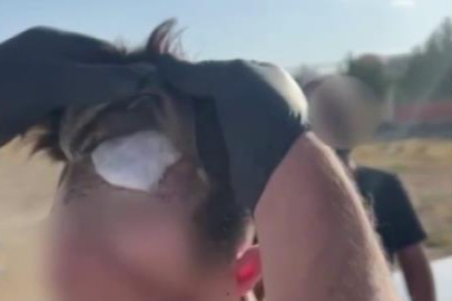 Protez saçtan uyuşturucu çıktı