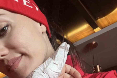 Fahriye Evcen kaza geçirdi