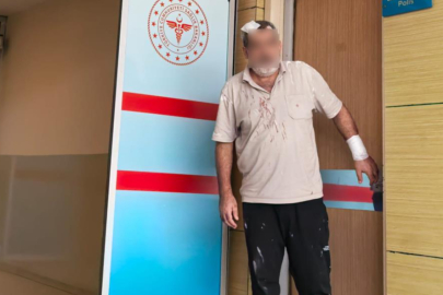 Bursa'da aile içi tencere ve bıçaklı kavga