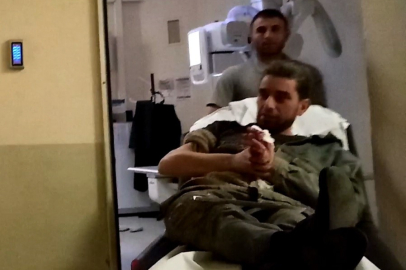 Bursa'da feci iş kazası: İşçinin parmağı koptu