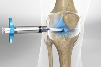 Op. Dr. Nar: “Hidrojel tedavisi eklem ağrılarında yenilikçi bir çözüm"