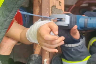 Oyun oynarken dehşeti yaşadı: Kolu demir korkuluğa saplandı