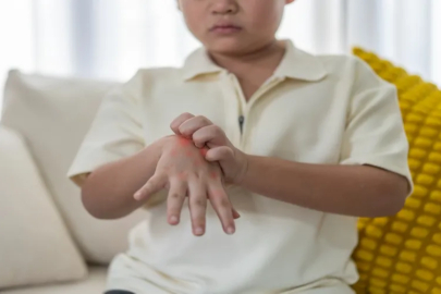 EAAH tehlikesi: Yazın çocuklarda daha sık görülüyor, takip şart