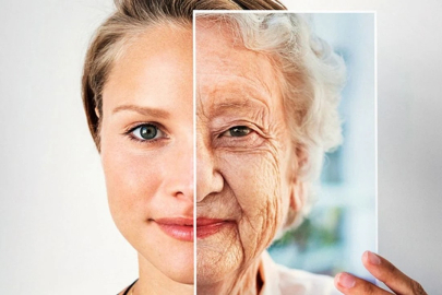 Bursa’da uzmanlar uyarıyor: Güneş cilt yaşlanmasının başlıca nedeni