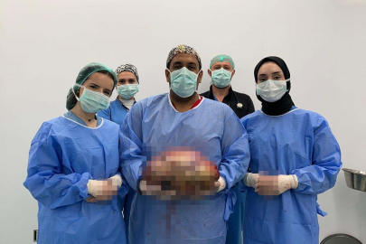 Bursa'da hayat kurtaran ameliyat: 10 kiloluk kitle başarıyla çıkarıldı