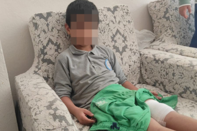 Orhangazi’de 8 yaşındaki çocuğa sokak köpeği saldırdı