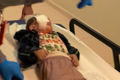 Bursa'da torpil faciası: 2 yaşındaki çocuk ağır yaralandı