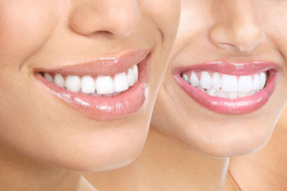 Sosyal medyada 'beyaz diş' tuzağı