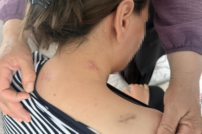 17 bıçak darbesi aldı, ölü numarasıyla kurtuldu