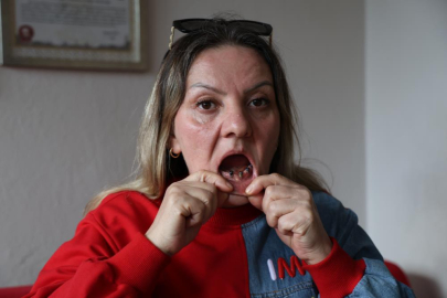 Diş ağrısı şikayetiyle gitti 25 dişinden oldu