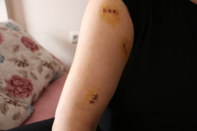 Nikahlı eşini 30 yerinden bıçakladı